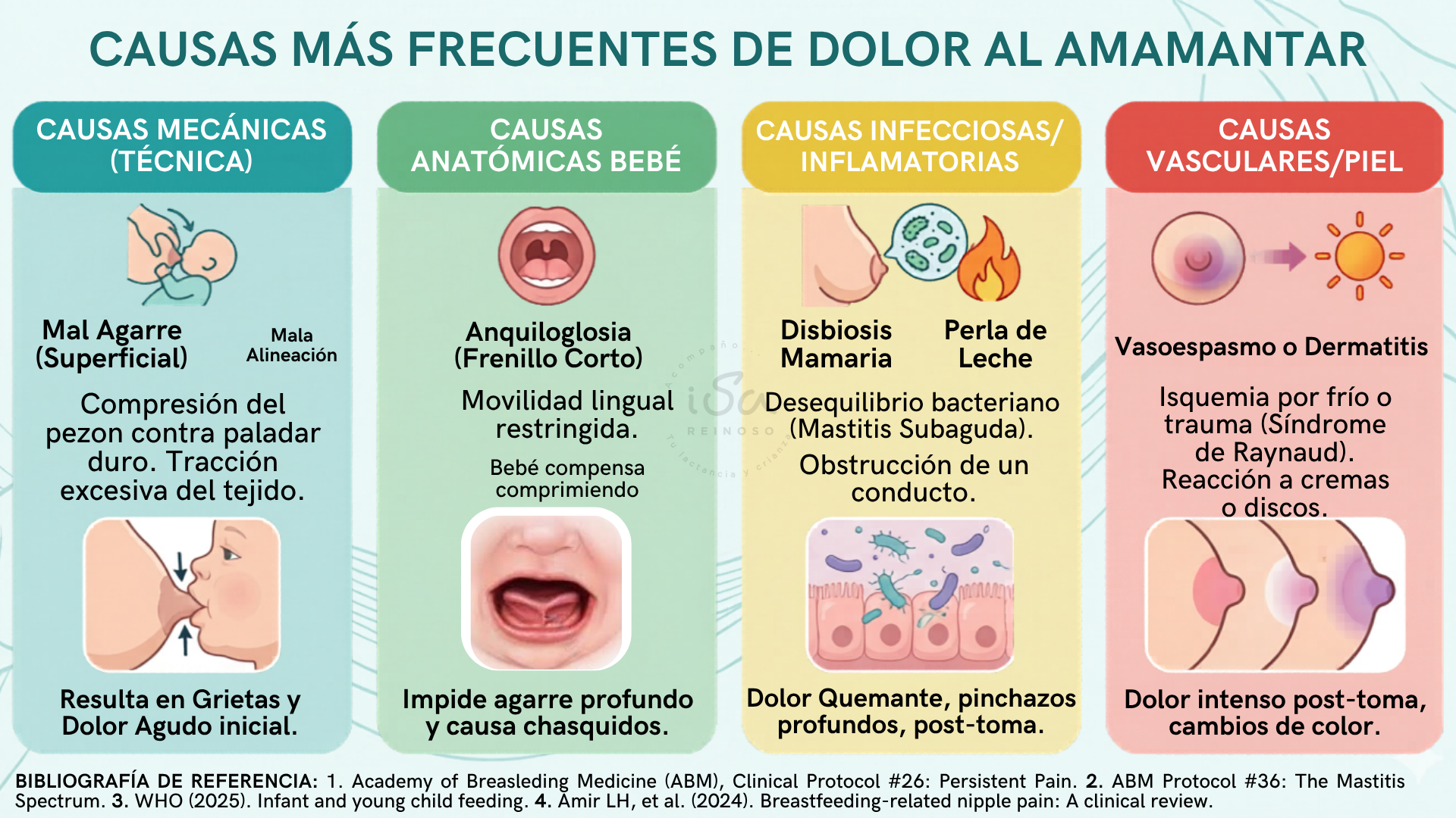 Esquema clínico de las causas de dolor en la lactancia por Isabel Reinoso, IBCLC. Clasifica el dolor en: 1. Mecánico (mal agarre y alineación que genera grietas). 2. Anatómico (anquiloglosia o frenillo corto que causa chasquidos). 3. Infeccioso (disbiosis mamaria y perlas de leche con dolor quemante). 4. Vascular (vasoespasmo y dermatitis con cambios de color e isquemia). Incluye citas de la Academy of Breastfeeding Medicine.